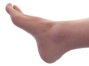 Regular Foot