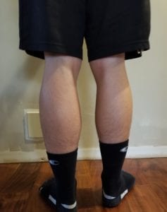 person 1 day 10 back of legs