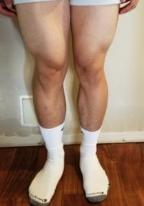 person 1 day 20 front of legs